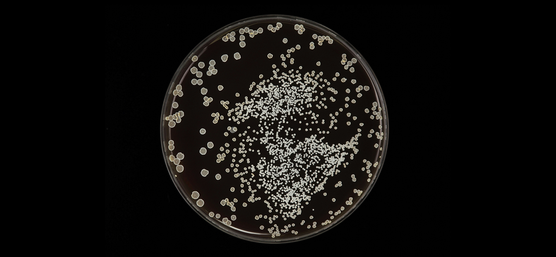 Yeast in a petri dish 